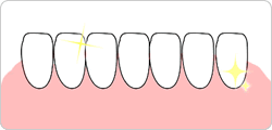 Step2:N[jO